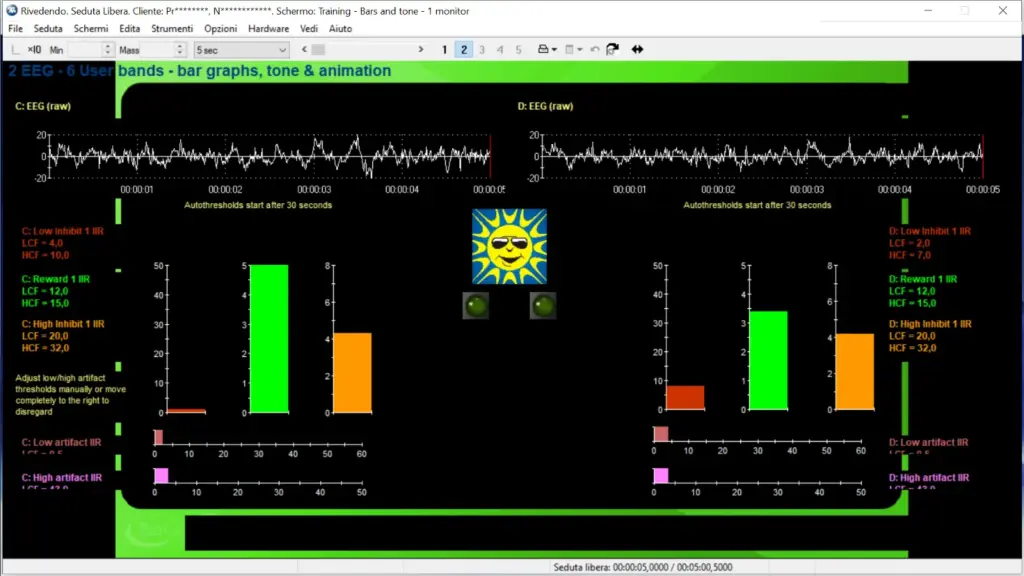 Neurofeedback